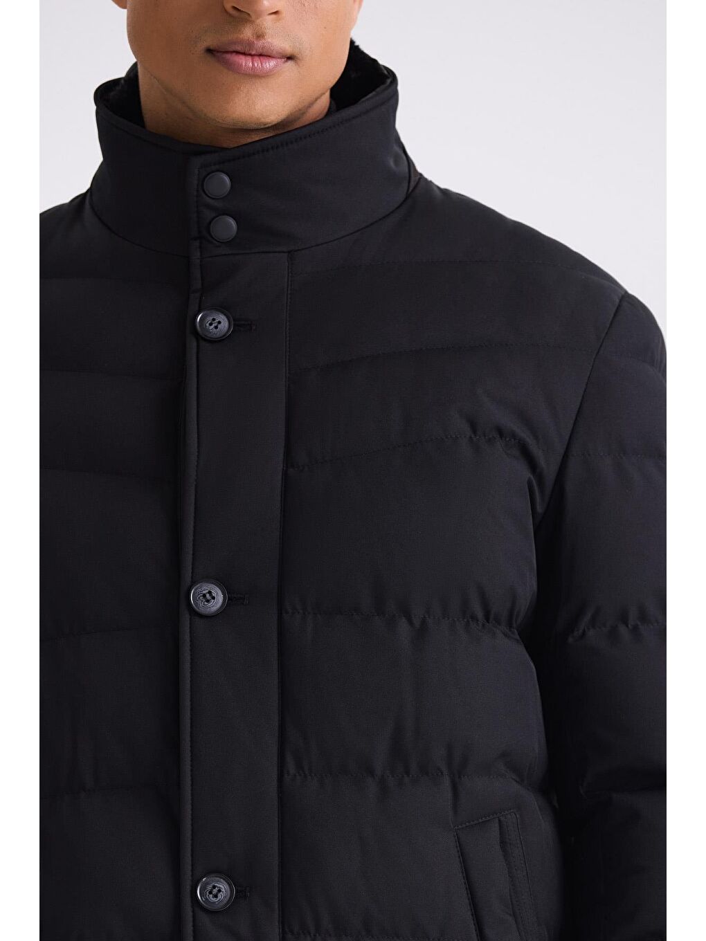 Siyah Regular Fit Yaka Kürklü Düğmeli Şişme Mont-3
