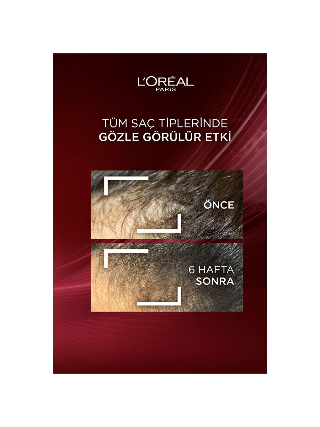 L'Oréal Paris Elseve Komple Direnç Dökülme Karşıtı Bakım Kremi 250ml-4