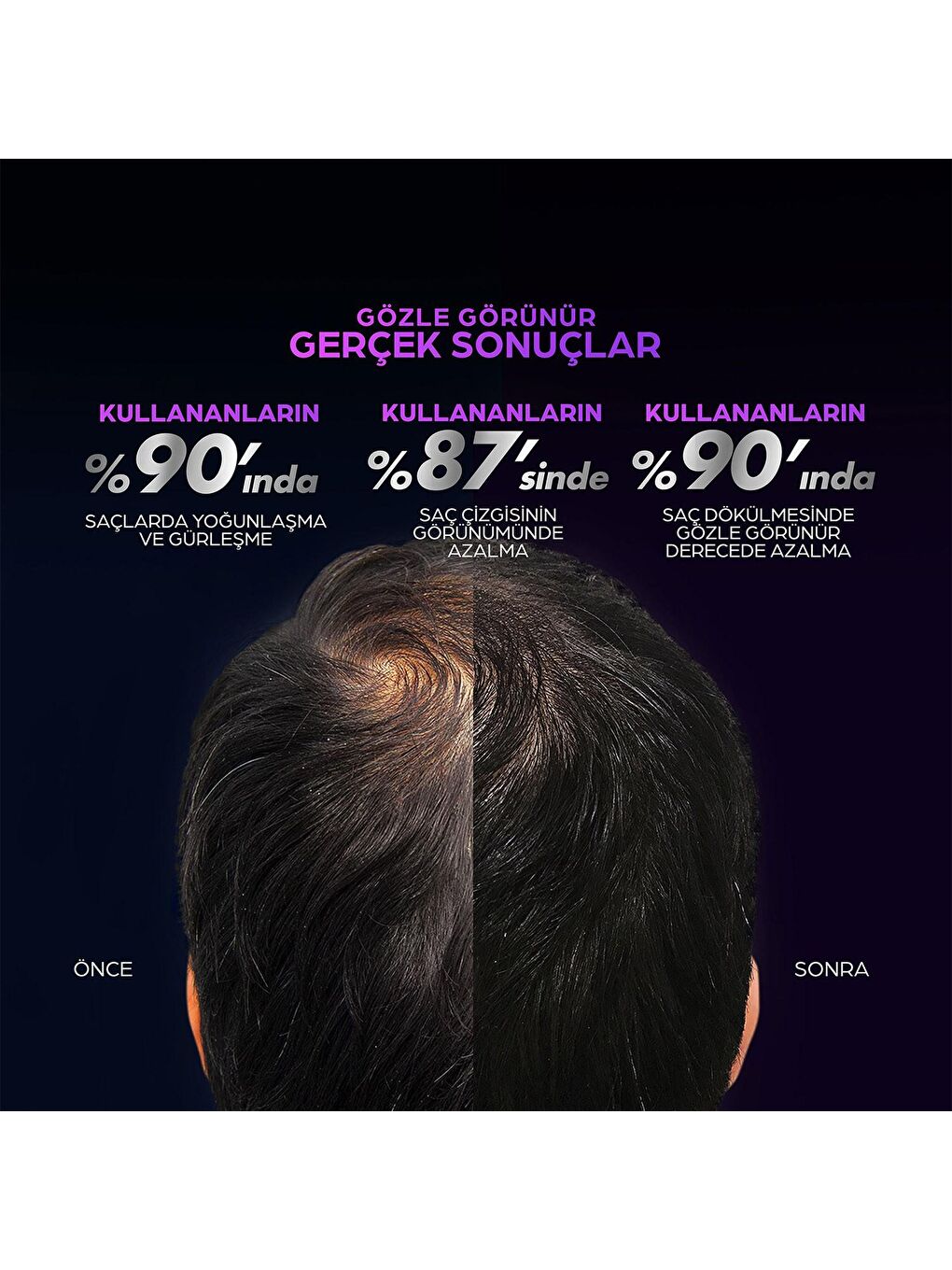 Clear Şeffaf Men Scalp Pro Saç Dökülmesine Karşı Güçlendirici Serum 70 ml - 3