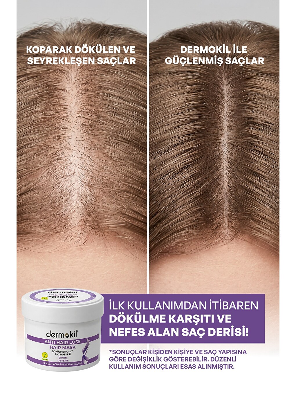 Dökülme Karşıtı (Biotine-Caffeine) Saç Bakım Maskesi 250 ml-3
