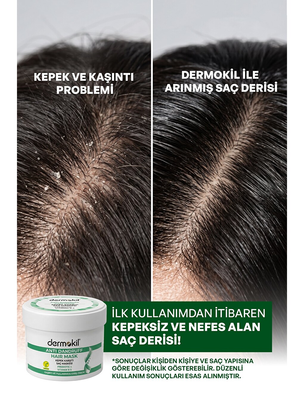 Kepeğe Karşı (Prebiotic-Vit B5) Saç Bakım Maskesi 250 ml-3
