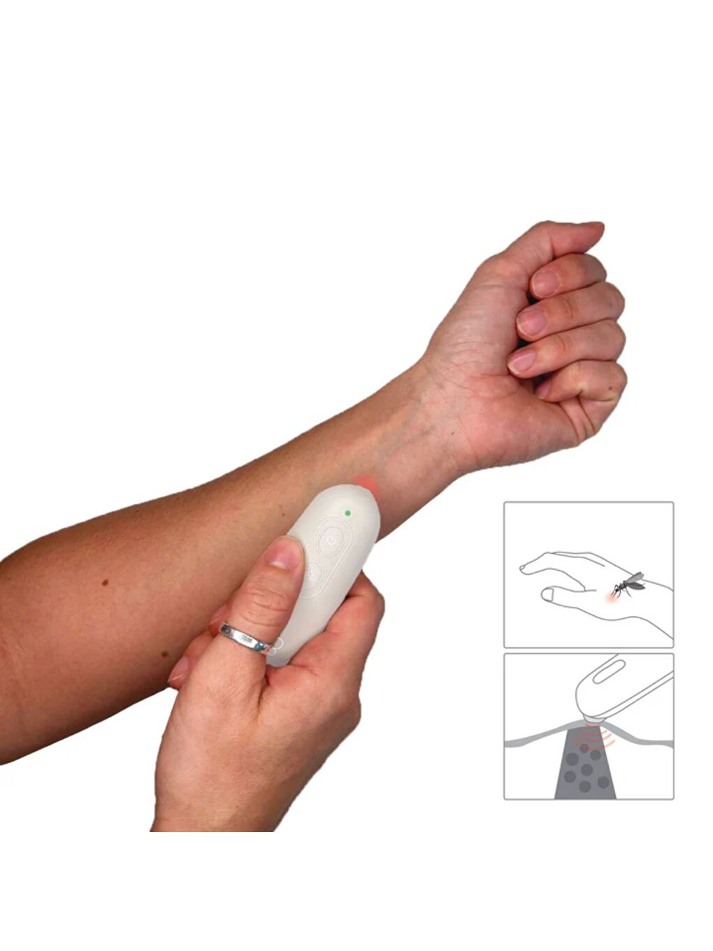 Büg Sinek ve Böcek Isırığı Yatıştırıcı-2