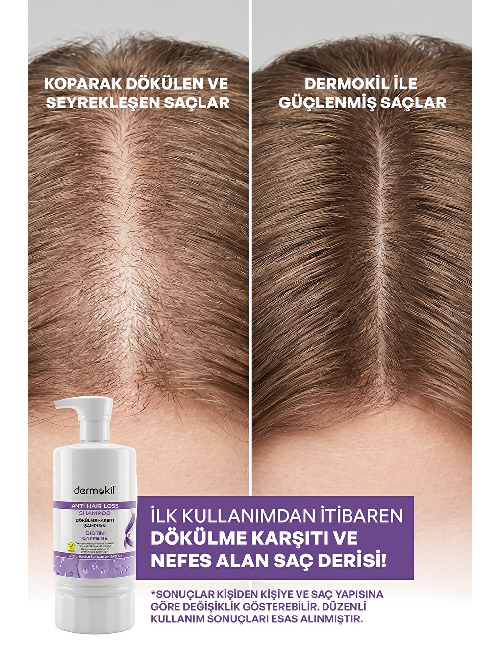 Biotin & Caffeine Dökülme Karşıtı Şampuan 950 ml x 2 Adet-3