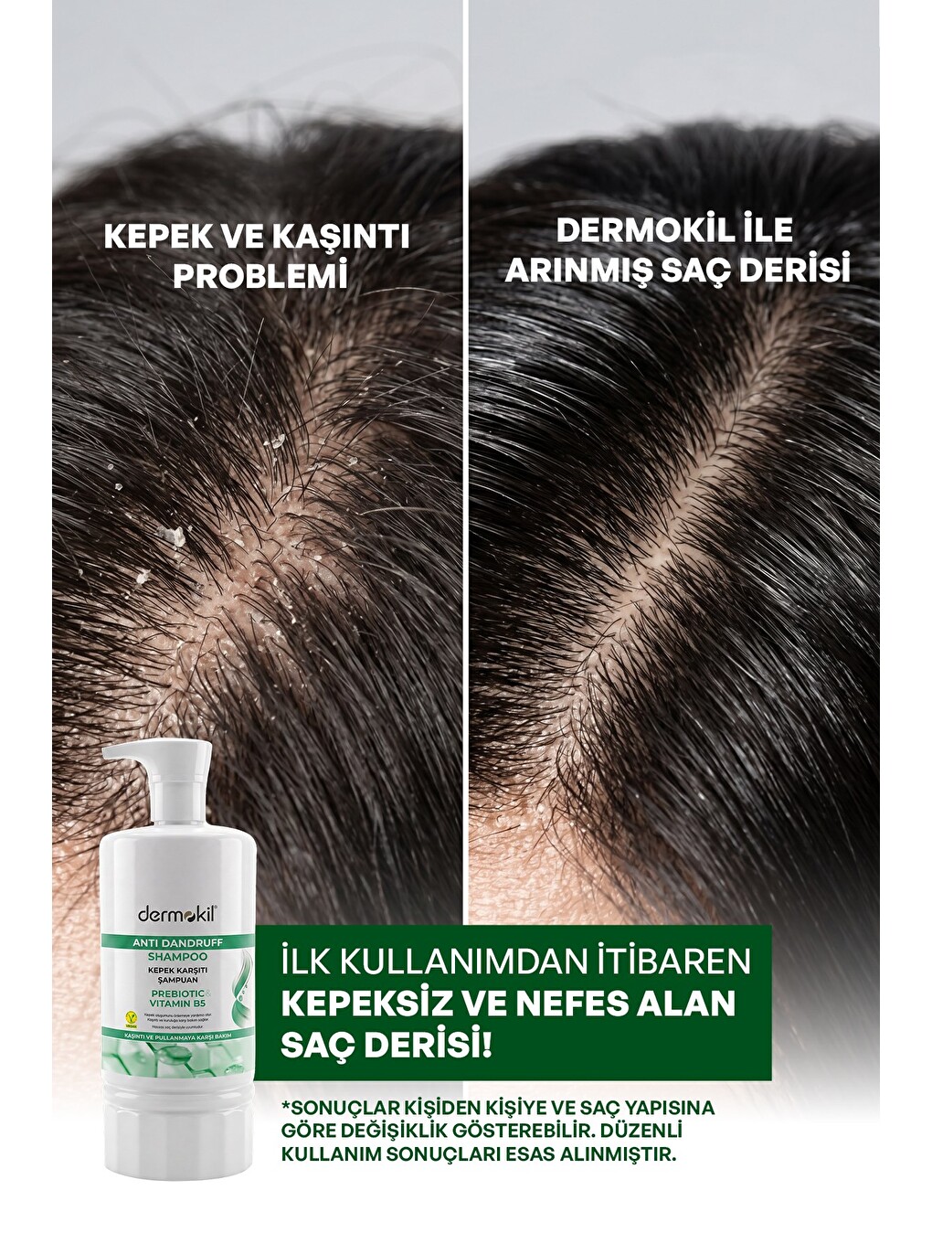 Prebiyotik & Vitamin B5 Kepeğe Karşı Şampuan 950 ml x 2 Adet-3