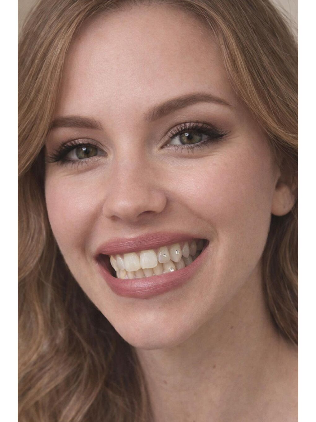 Zirkon Yapıştırma Diş Taşı-1