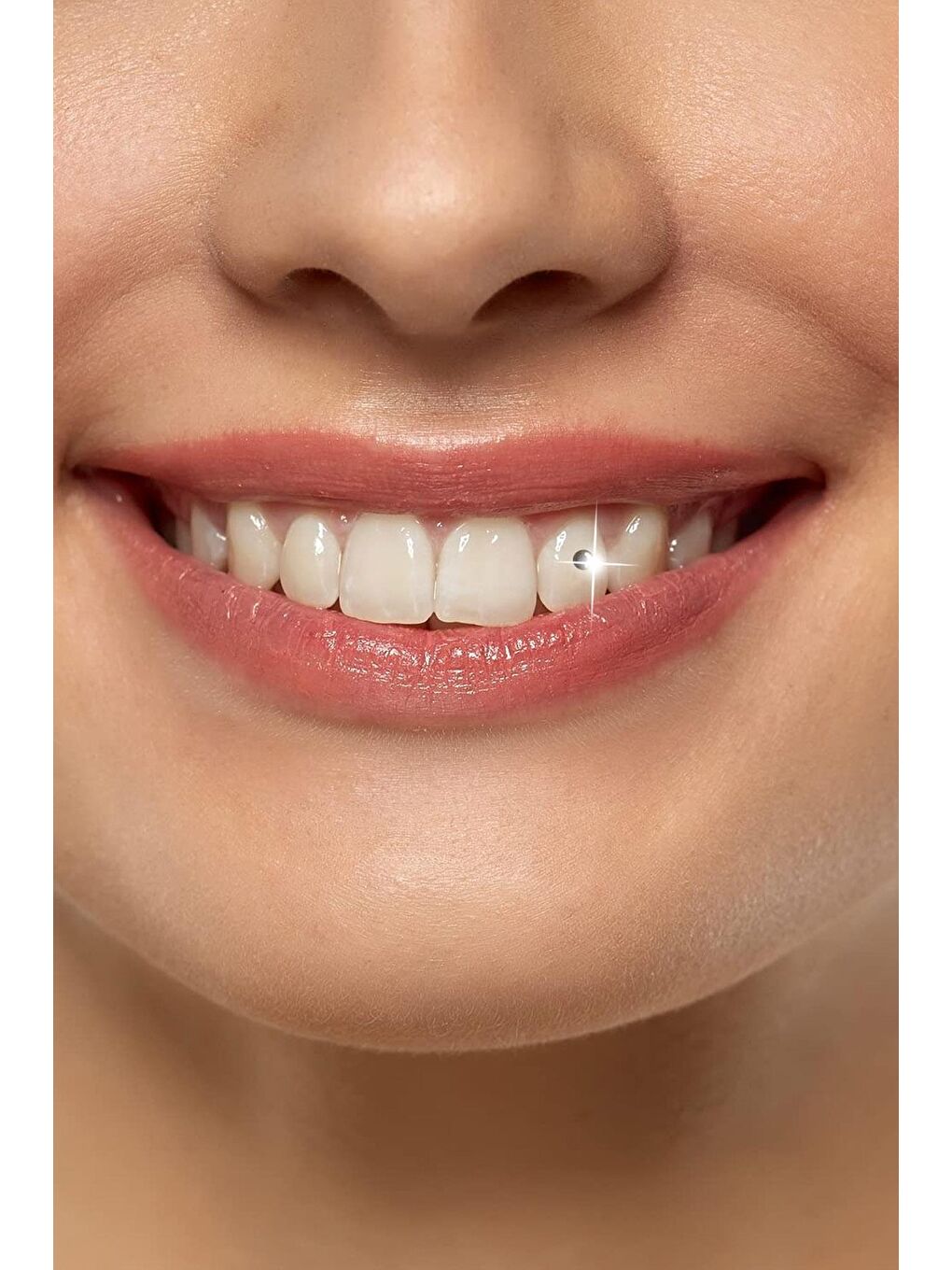 Zirkon Yapıştırma Diş Taşı-2