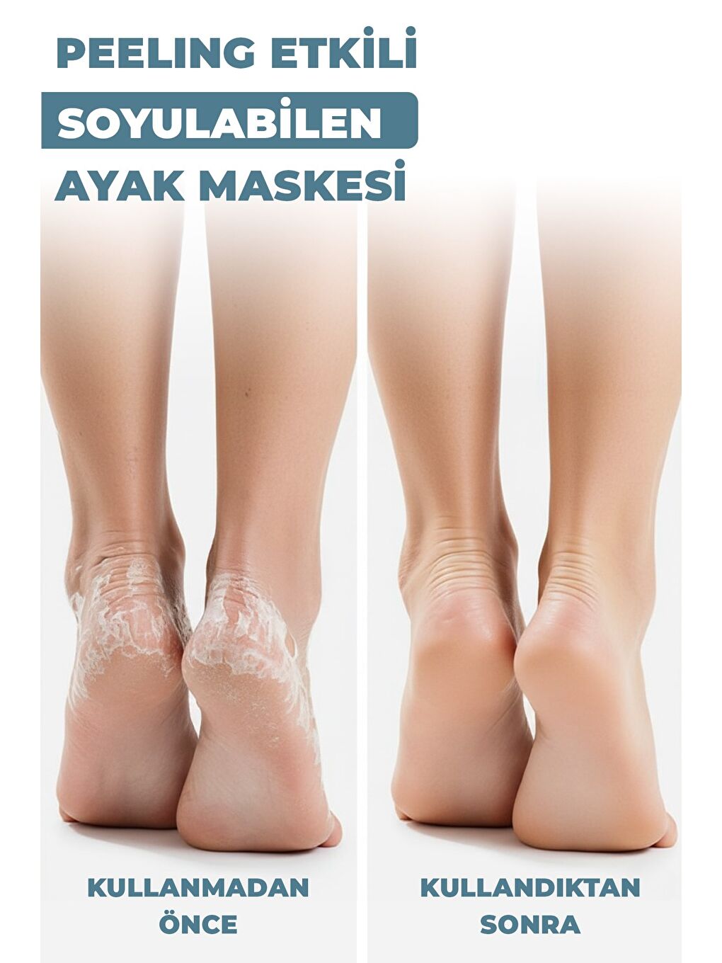 Peeling Etkili Çorap Tipi Soyulabilir Ayak Maskesi 30 ml x 3 Adet-1