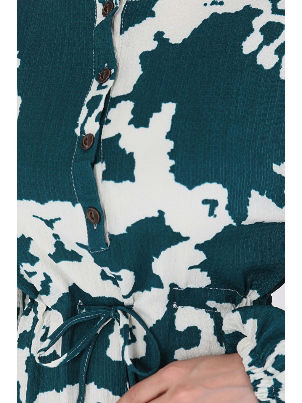 Yeşil Desenli Düğmeli Elbise Zumrut - 27189-4