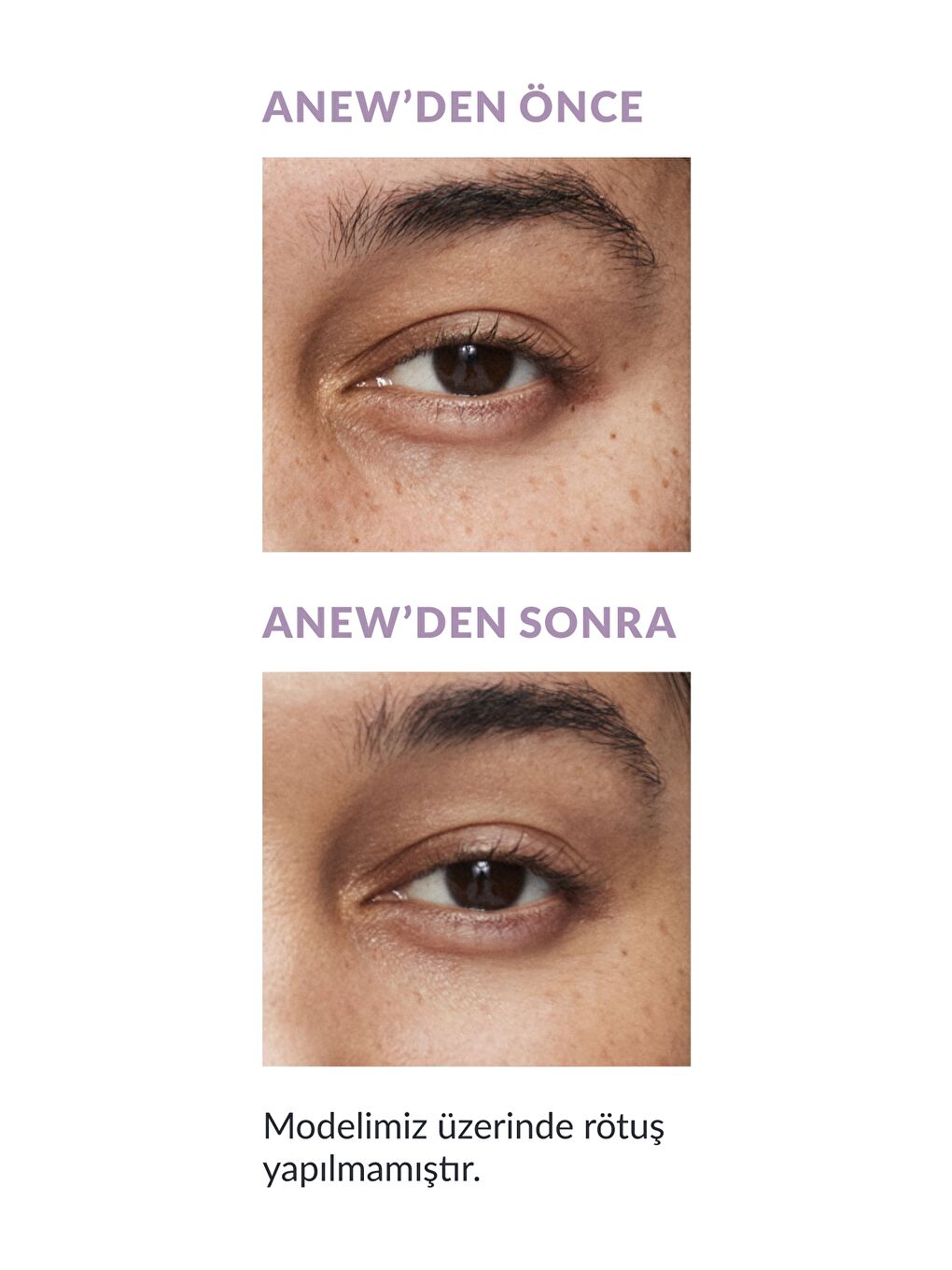 Anew Düzgünleştirici ve Tazeleyici Likit Kapatıcı 12ml - 12N Fair-5