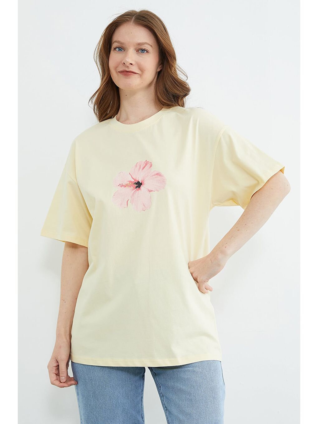 Sarı Hibiscus Çiçeği Baskılı Oversize Tişört-2