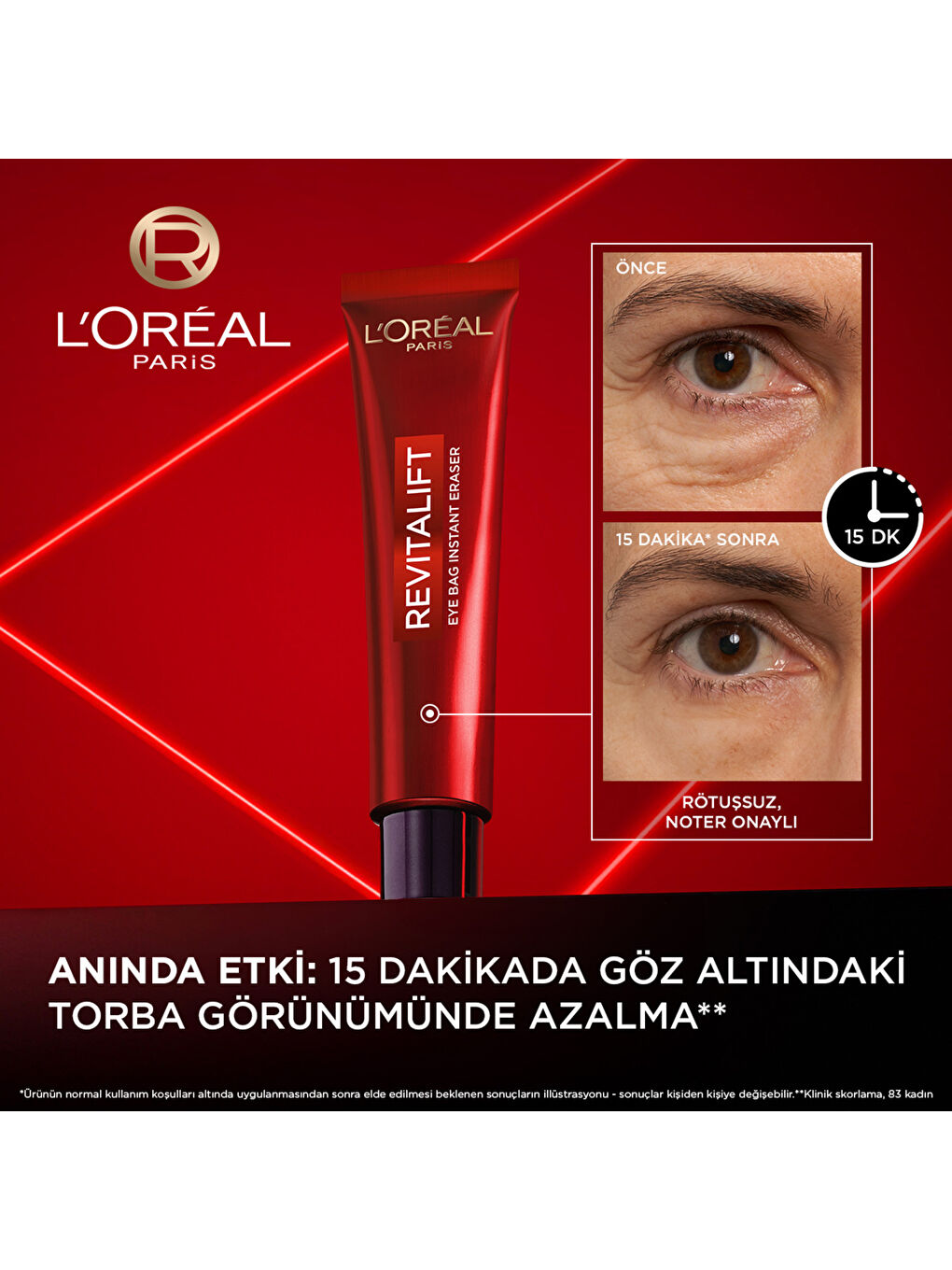 Revitalift Lazer Eyebag Instant Eraser Göz Altı Torba Görünümüne Karşı Etkili Göz Kremi 15ml-1