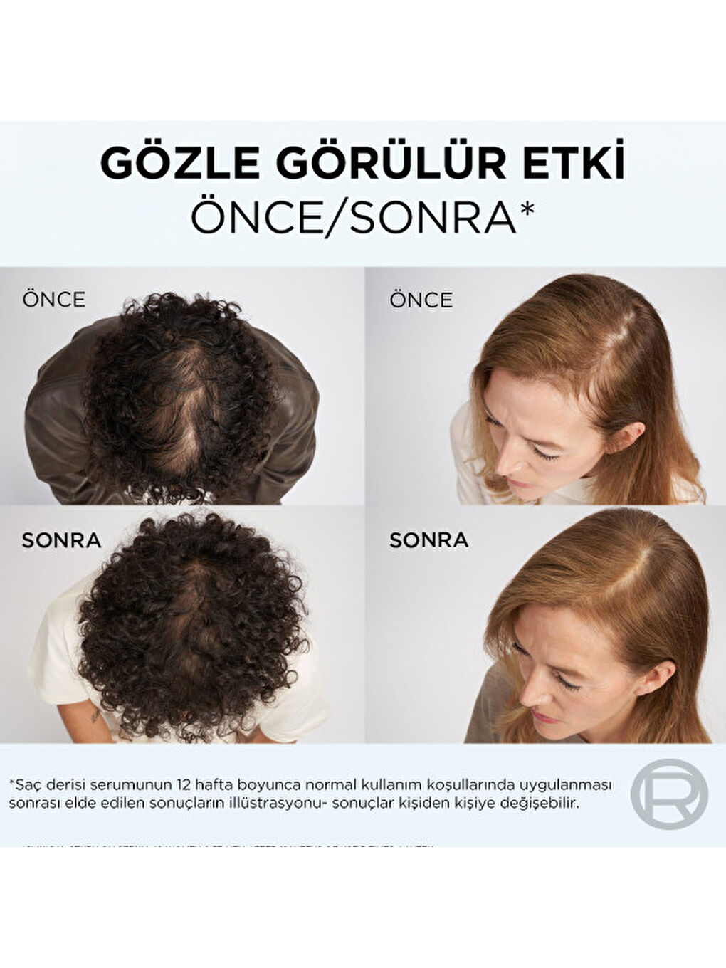 Elseve Growth Booster Dökülme Karşıtı Şampuan 200ml-4