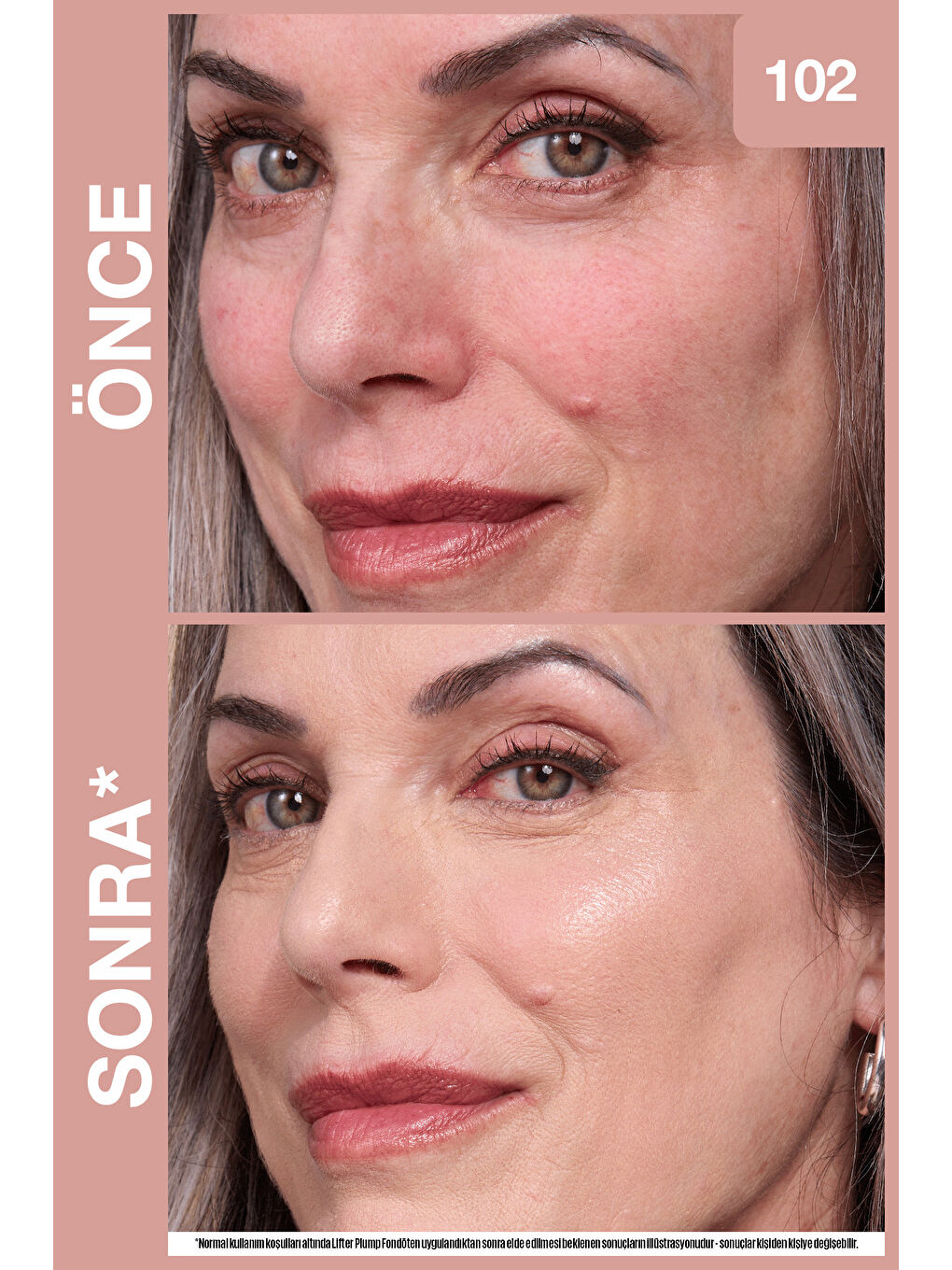 Lifter Niasinamid ve Hyalüronik Asit İçeren Aydınlatan Fondöten - 102-4