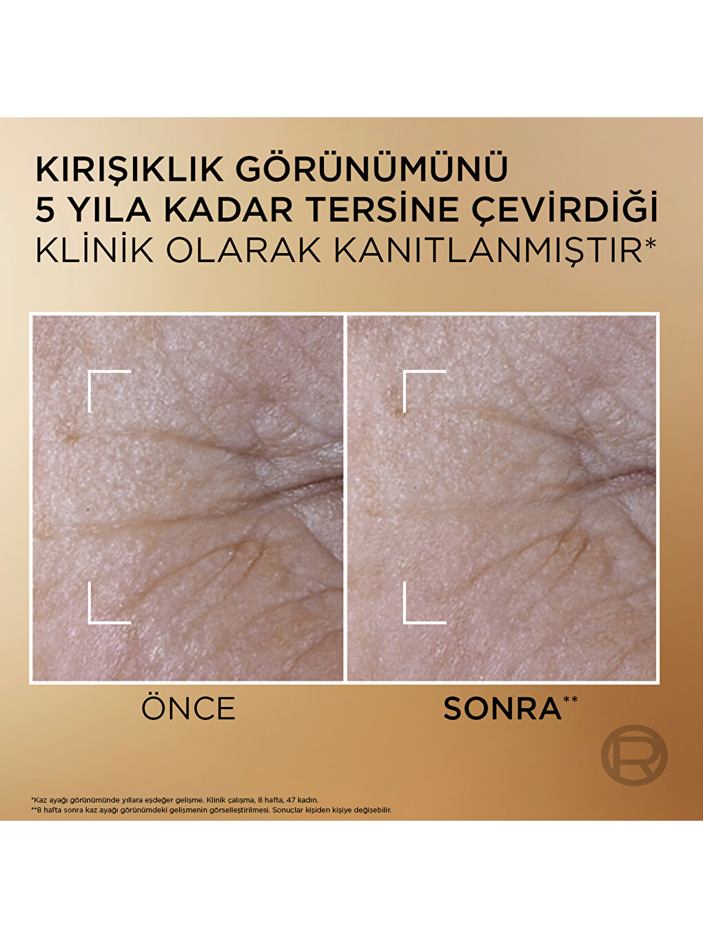 L'oréal Paris Age Perfect [kolajen] İçerikli Cilt Yenileyici Çift Fazlı Serum 30ml-5