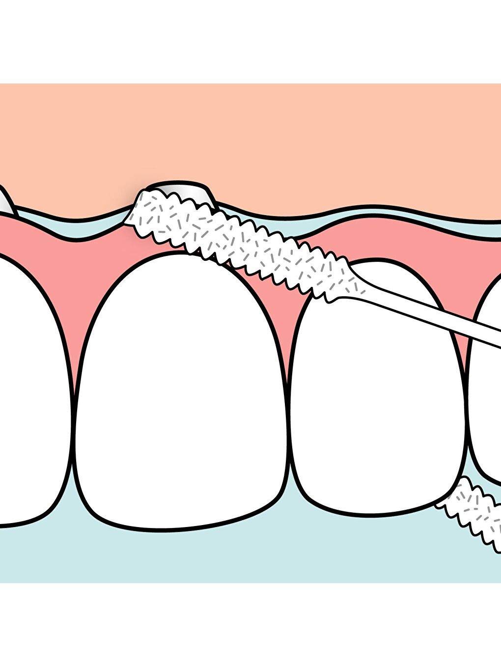 Tepe Renksiz İmplant Floss Diş İpi - 5