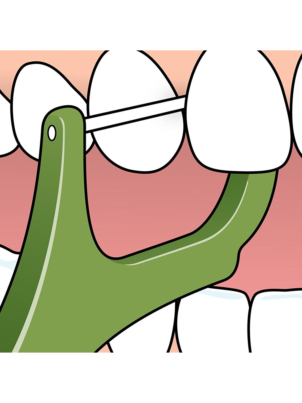 Tepe Renksiz Mini Flosser Çatallı 36 Adet - 3