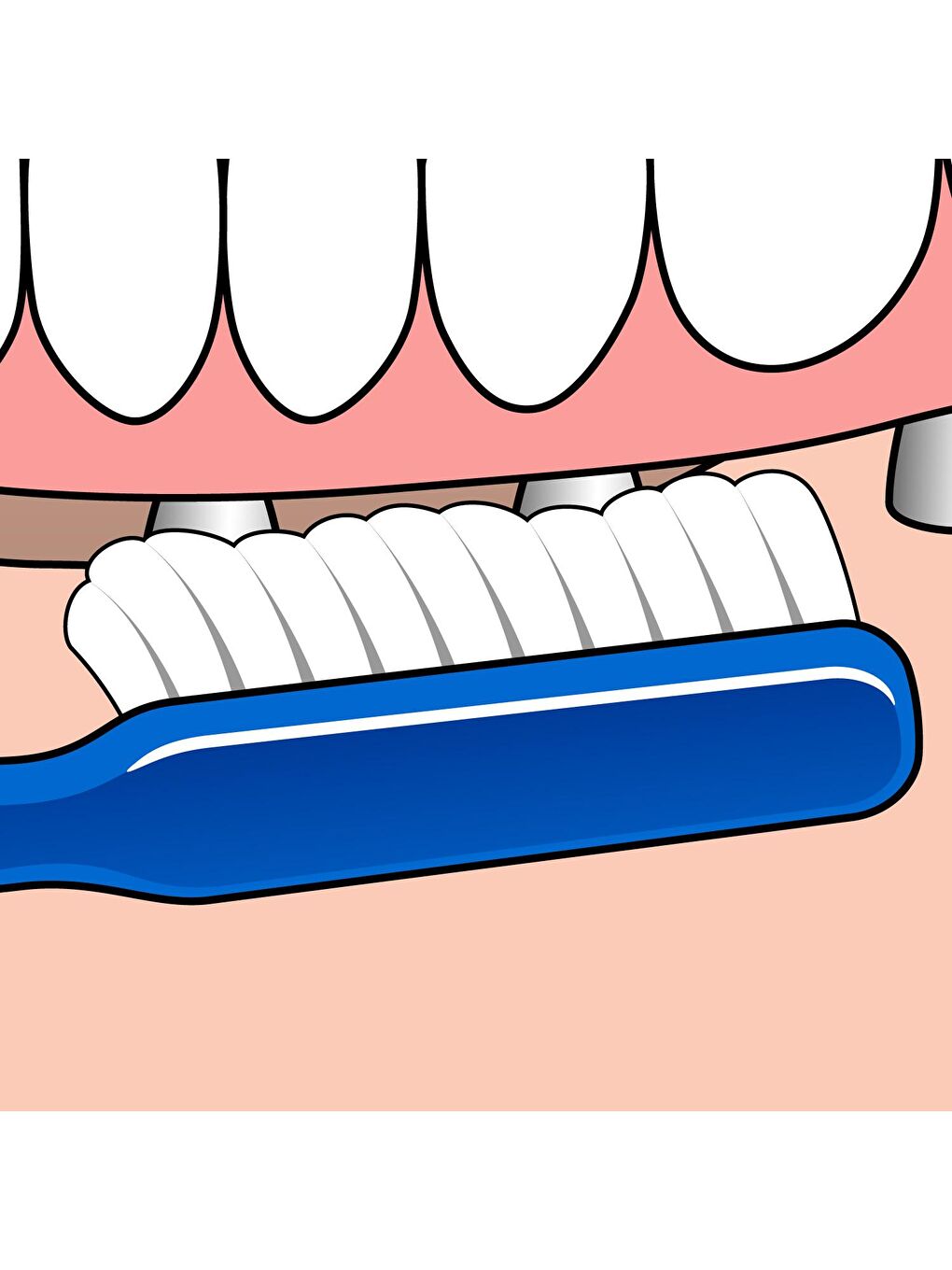 Tepe Renksiz Implant Orthodontic Diş Fırçası 1 Adet - 2