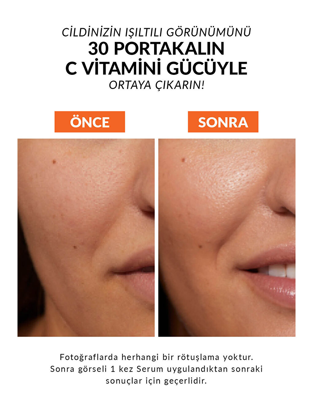 AVON Anew Vitamin C Canlandırıcı Serum 30 Ml. - 2