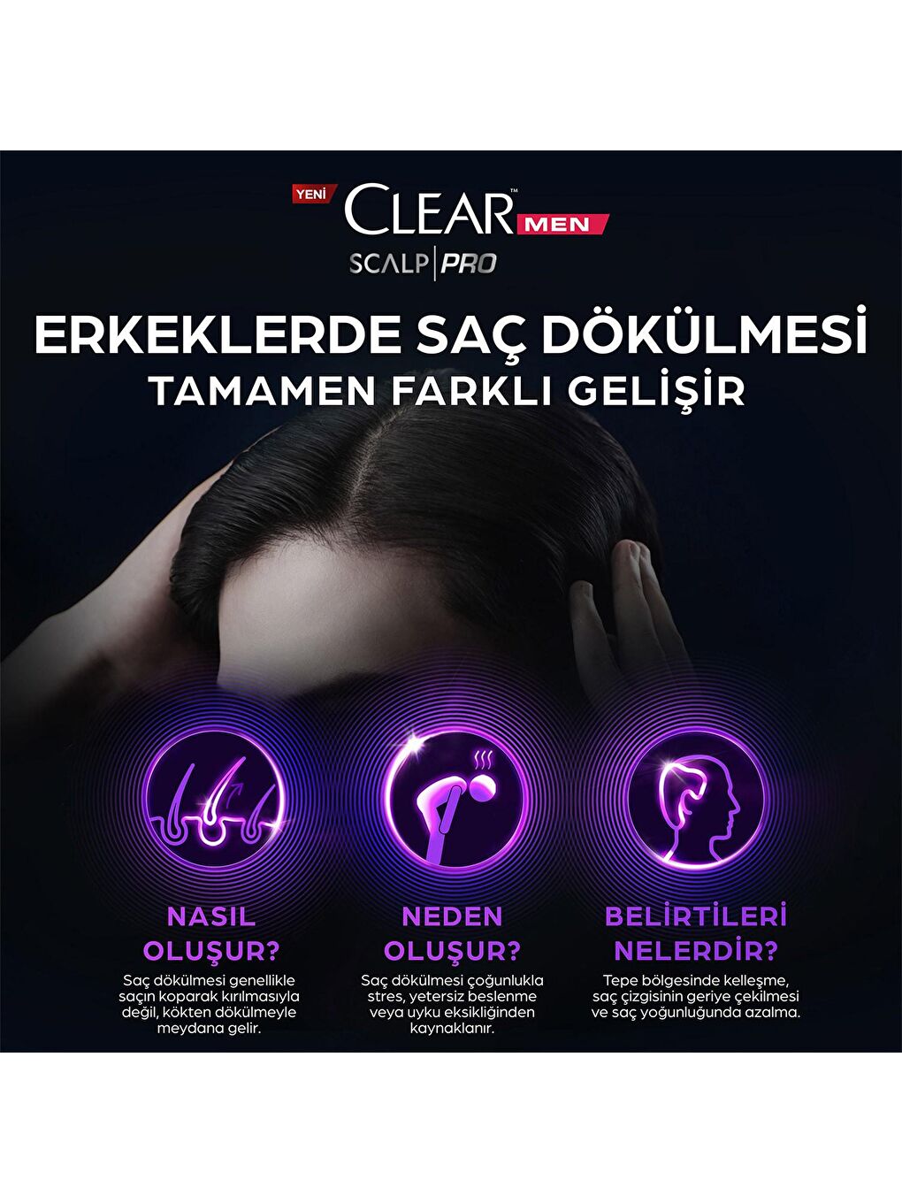 Clear Renksiz Men Scalp Pro Saç Dökülmesine Karşı Güçlendirici Şampuan 300 ml - 2