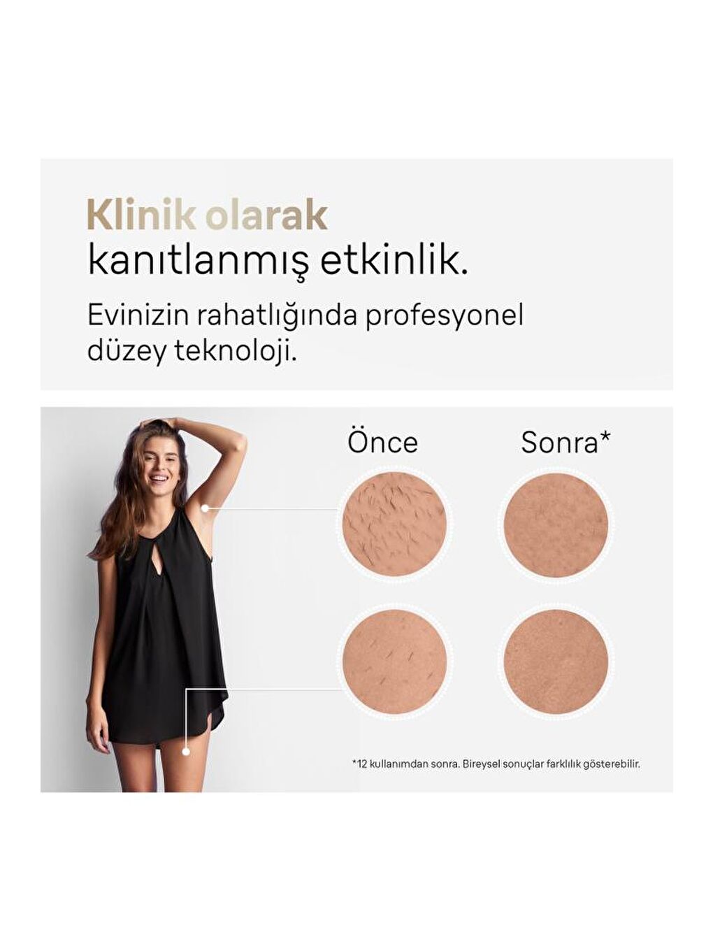 IPL Silk·expert Pro 5, Evde Tüy Alma, Çanta, Venus Tıraş Makinesi, 2 Başlık ile, PL5146-3