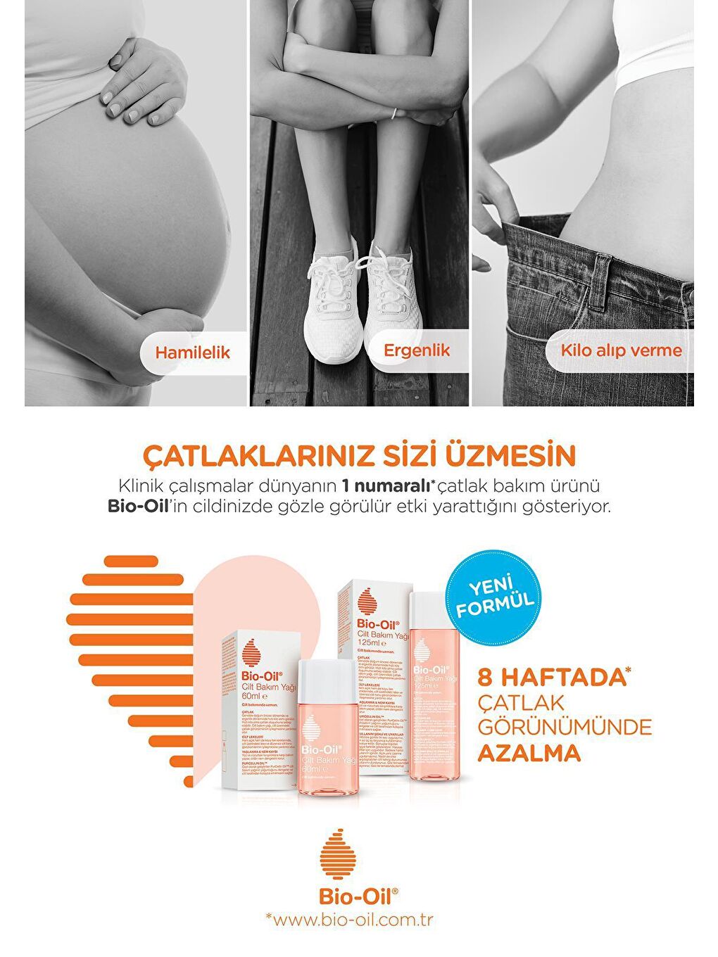 BIO OIL Renksiz Çatlak Karşıtı & Nemlendirici Cilt Bakım Yağı 125 ml (3'lü paket) - YENİ FORMÜL - 4