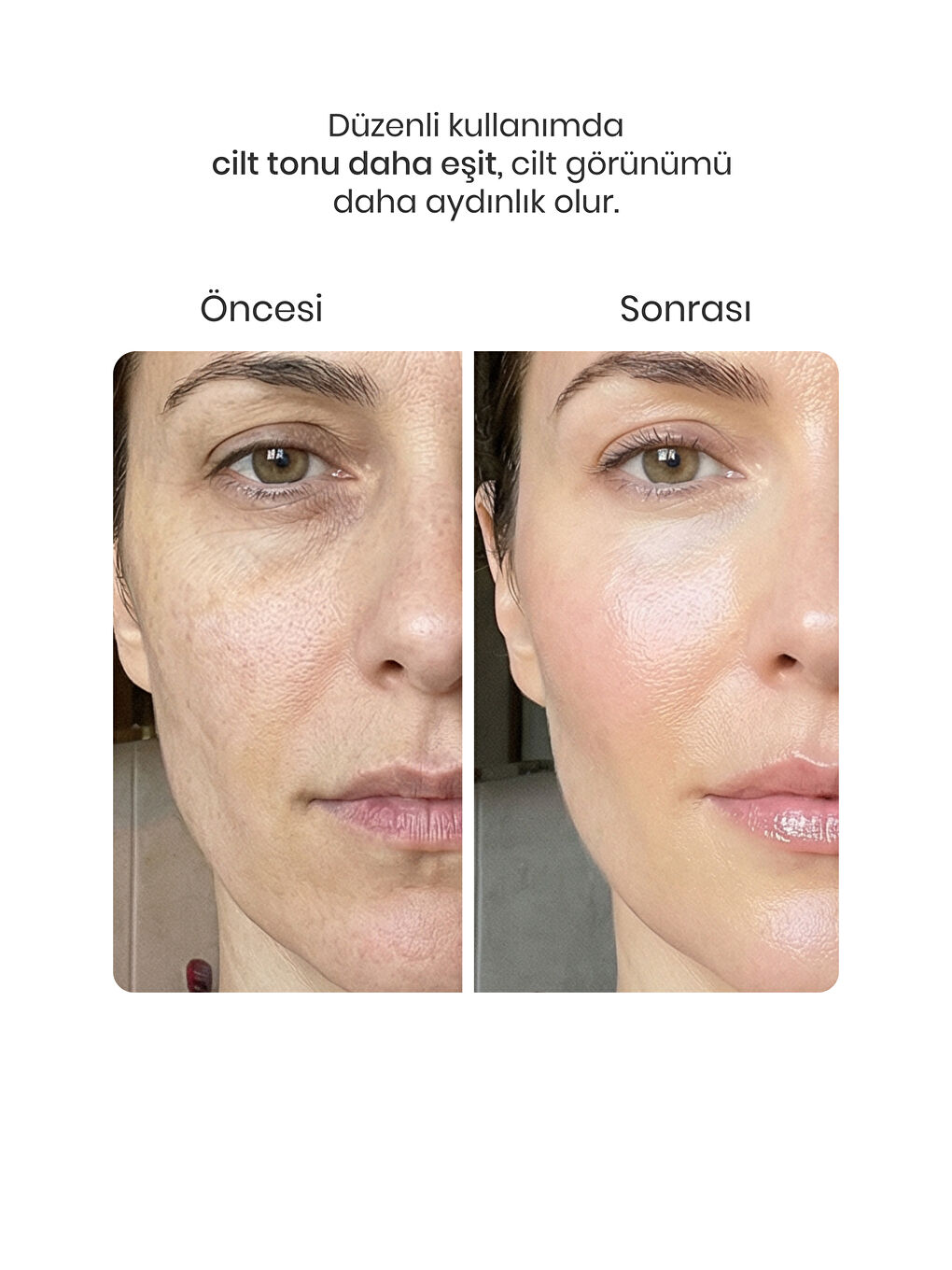 Leke Karşıtı Aydınlatıcı Cilt Bakım Kremi-1