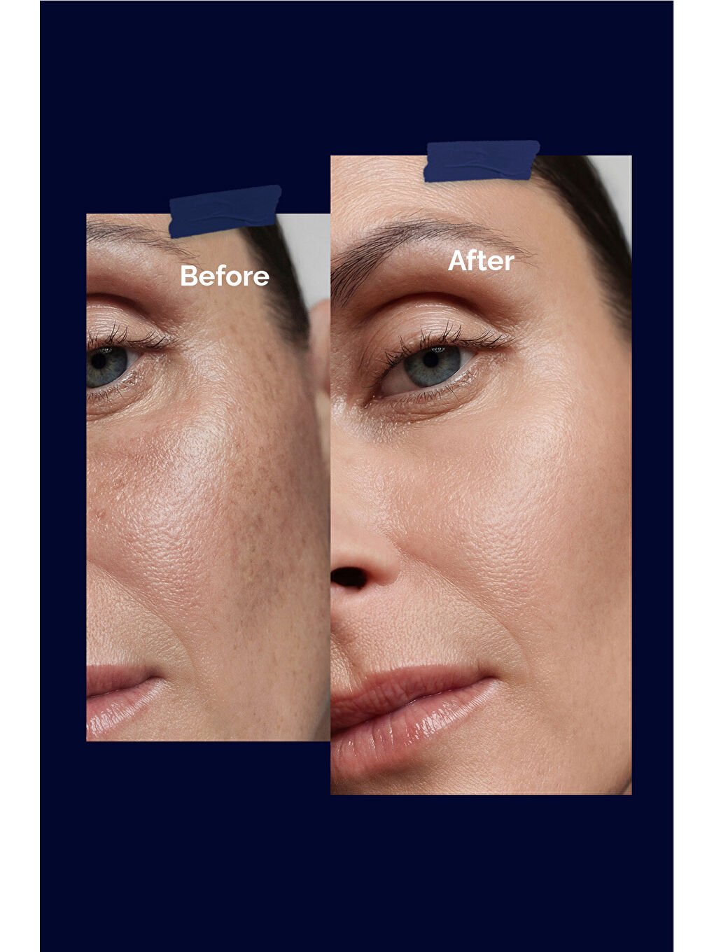 Leke Karşıtı Aydınlatıcı Cilt Bakım Kremi-1