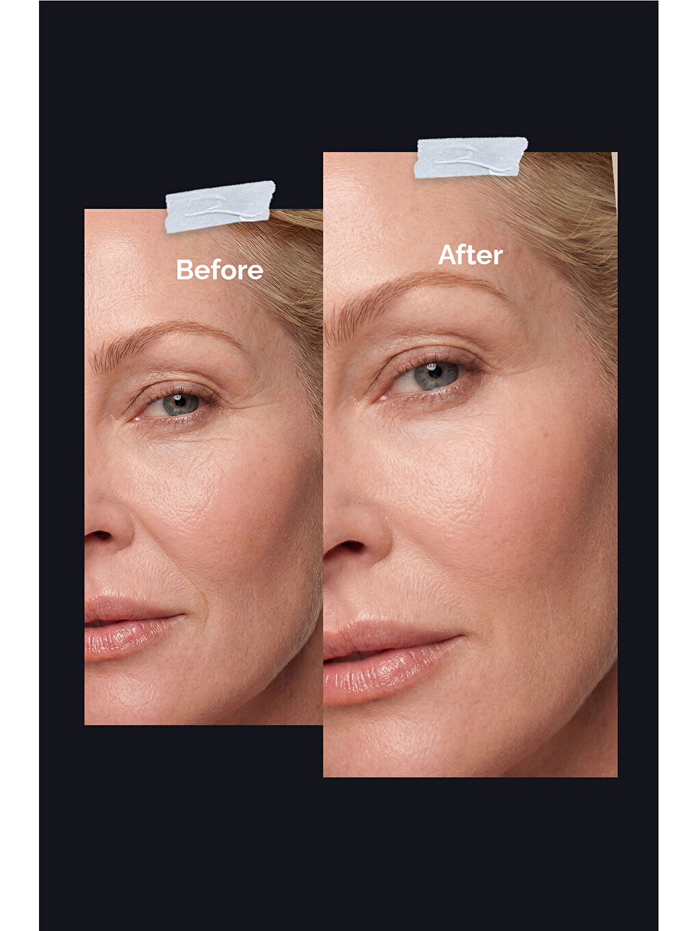 Anti-aging Kırışıklık Karşıtı Yenileyici Krem-1