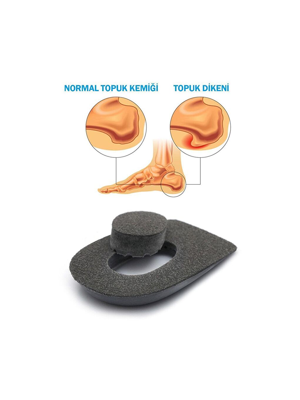 Heelspur Epin Topukluk Gri Topuk Dikeni Tabanlık-1