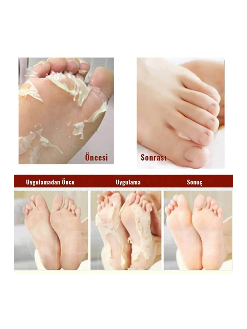 Mj Care Çorap Tipi Ayak Peeling Maskesi - 2