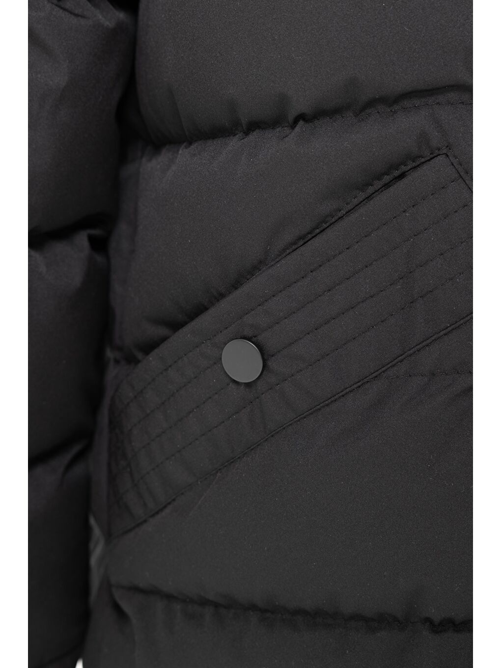 Erkek Çıkarıbilir Kapüşonlu Su Geçirmez  Şişme Mont Kaban Siyah-4