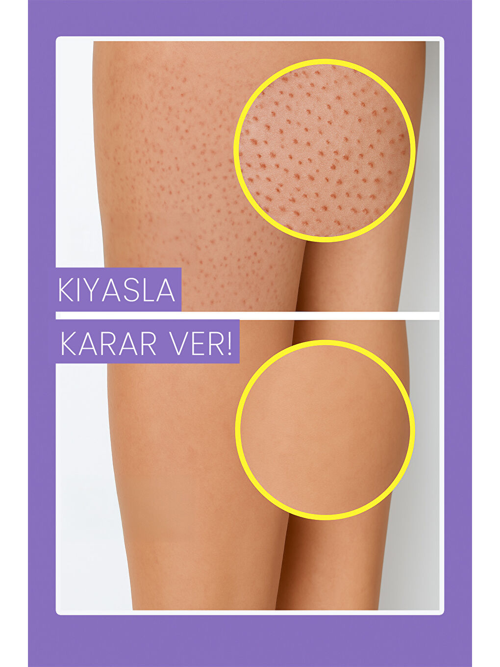 Luis Bien Tüy Dökücü Set ( Unisex Tüy Dökücü Krem Epilasyon Sonrası Nemlendirici Ve Tüy Inceltici Süt )