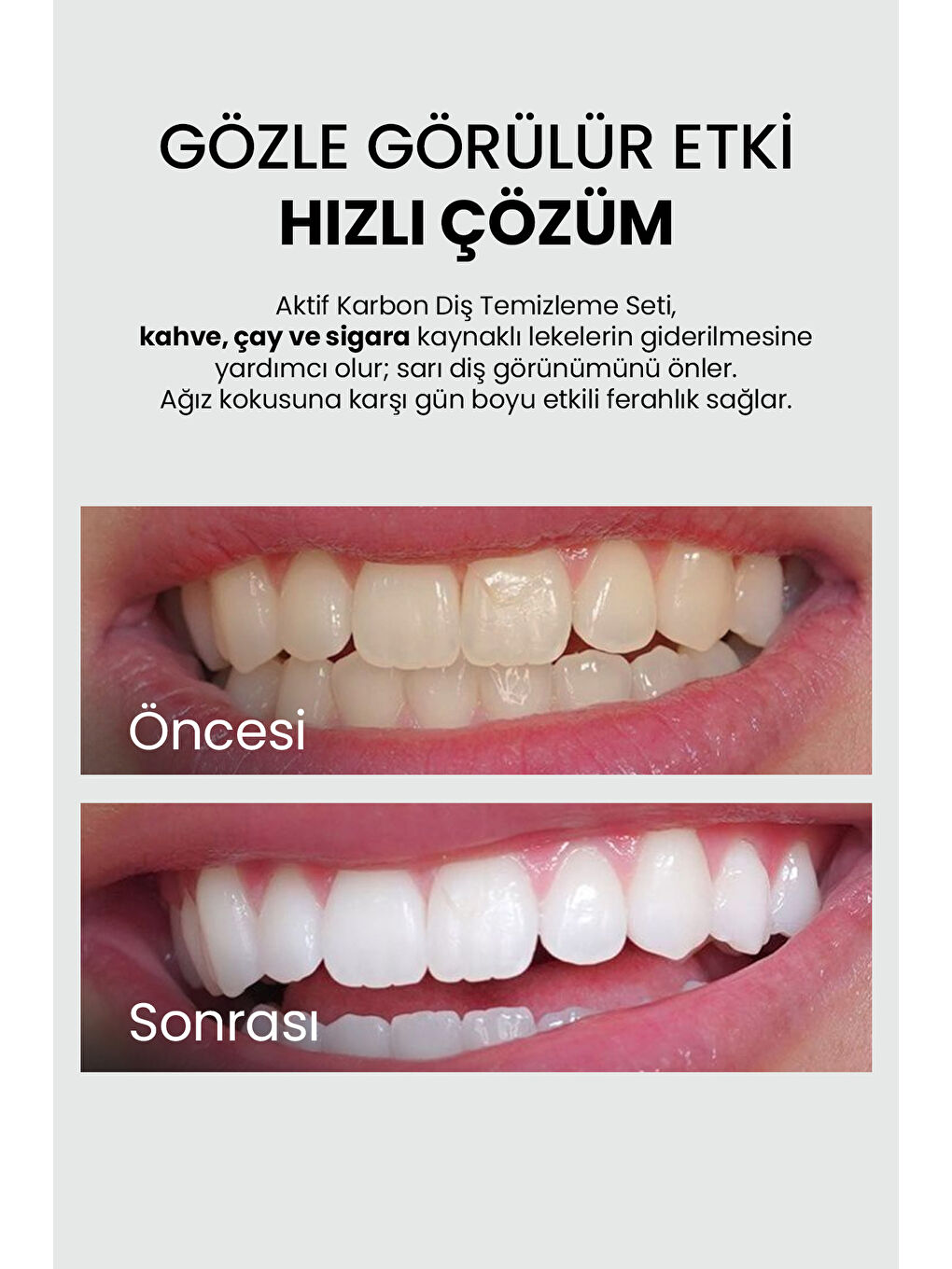 Ağız Bakım Seti ( Aktif Karbon Diş Tozu + Aktif Karbon Diş Macunu +Naneli Ağız Bakım Suyu)-1