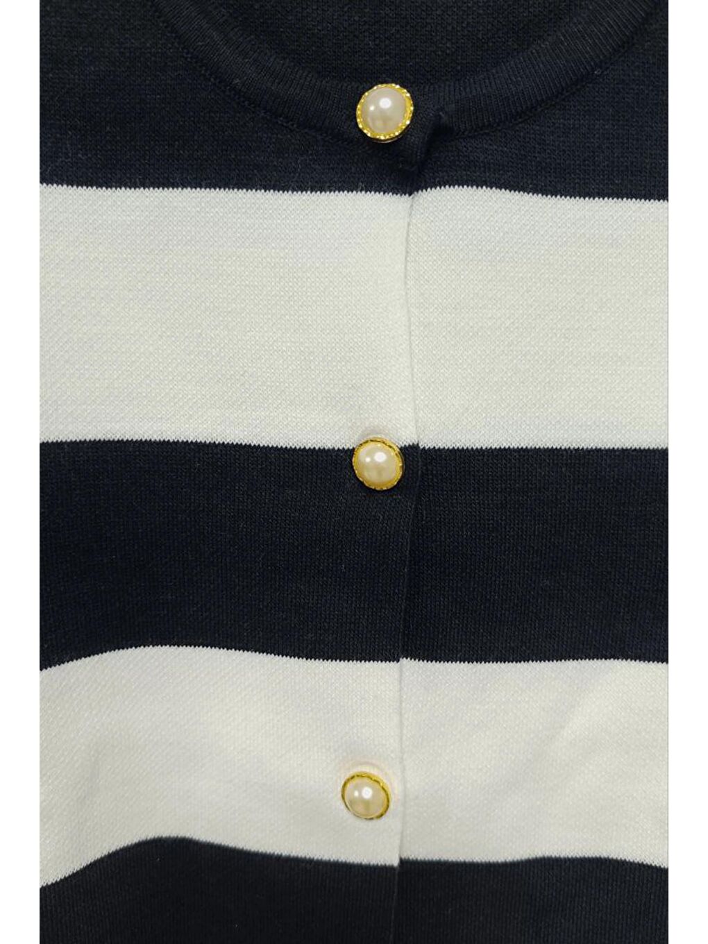 Siyah Beyaz Çizgili Düğmeli Ceket-2