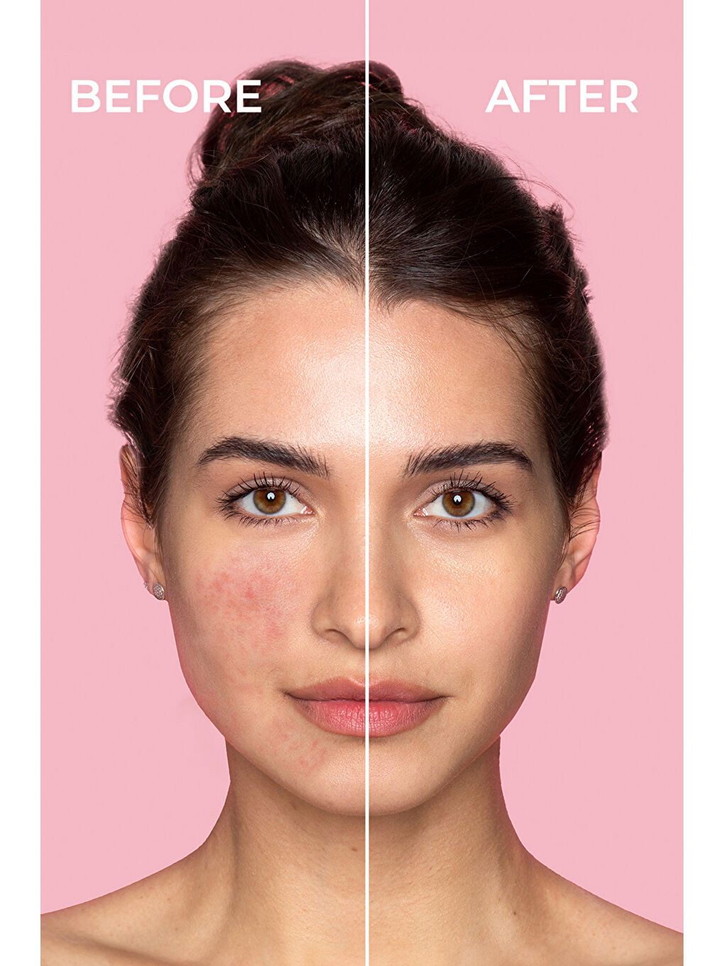 Pure Cica Tiger Grass Ton Eşitleyici Yoğun Onarıcı Yatıştırıcı Kızarıklık Karşıtı Yüz Kremi 15 ML-5