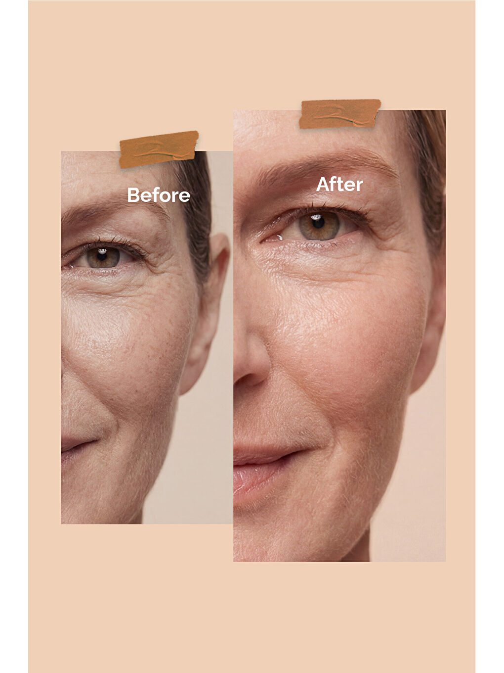 Sebum Dengeleyici Leke Karşıtı Niacinamide %10 Cilt Bakım Serumu-1