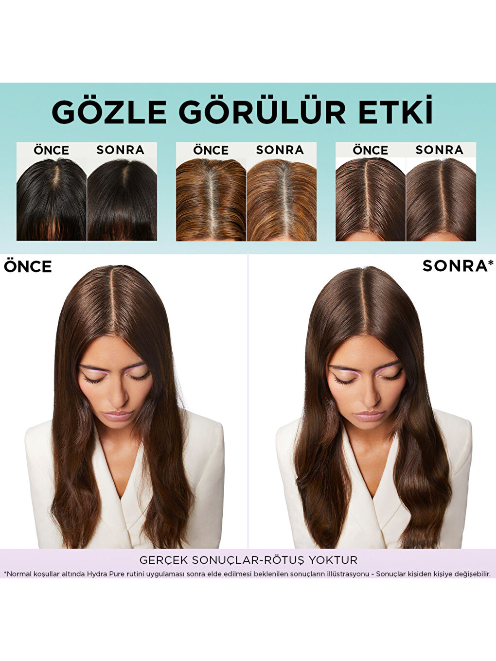 Elseve Hyaluron Pure Şampuan 300 Ml-3