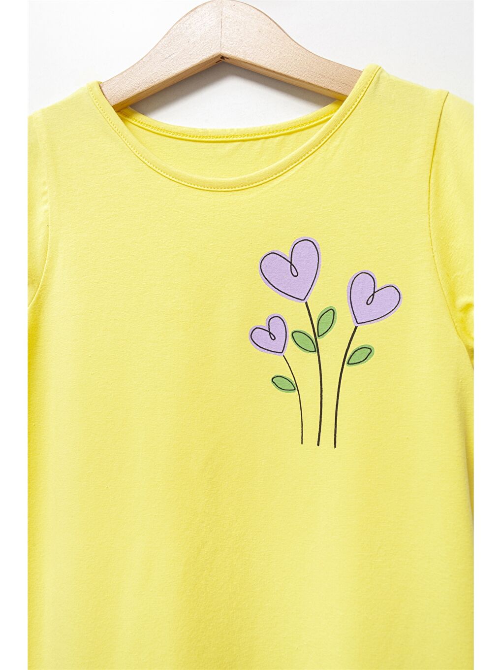 Sarı Bisiklet Yaka Baskılı Kız Çocuk Elbise-2