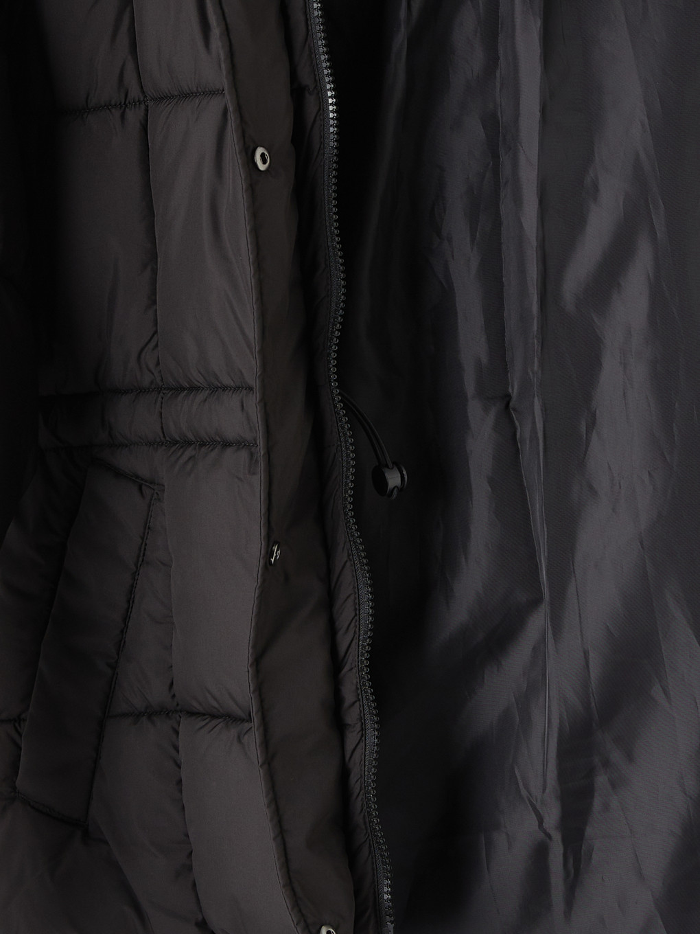 Siyah Kürk Kapüşonlu Oversize Kadın Şişme Mont-9